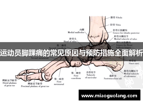 运动员脚踝痛的常见原因与预防措施全面解析
